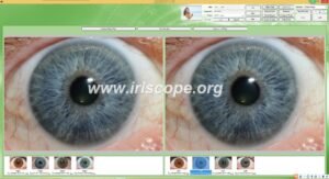 12MP Iriscopio