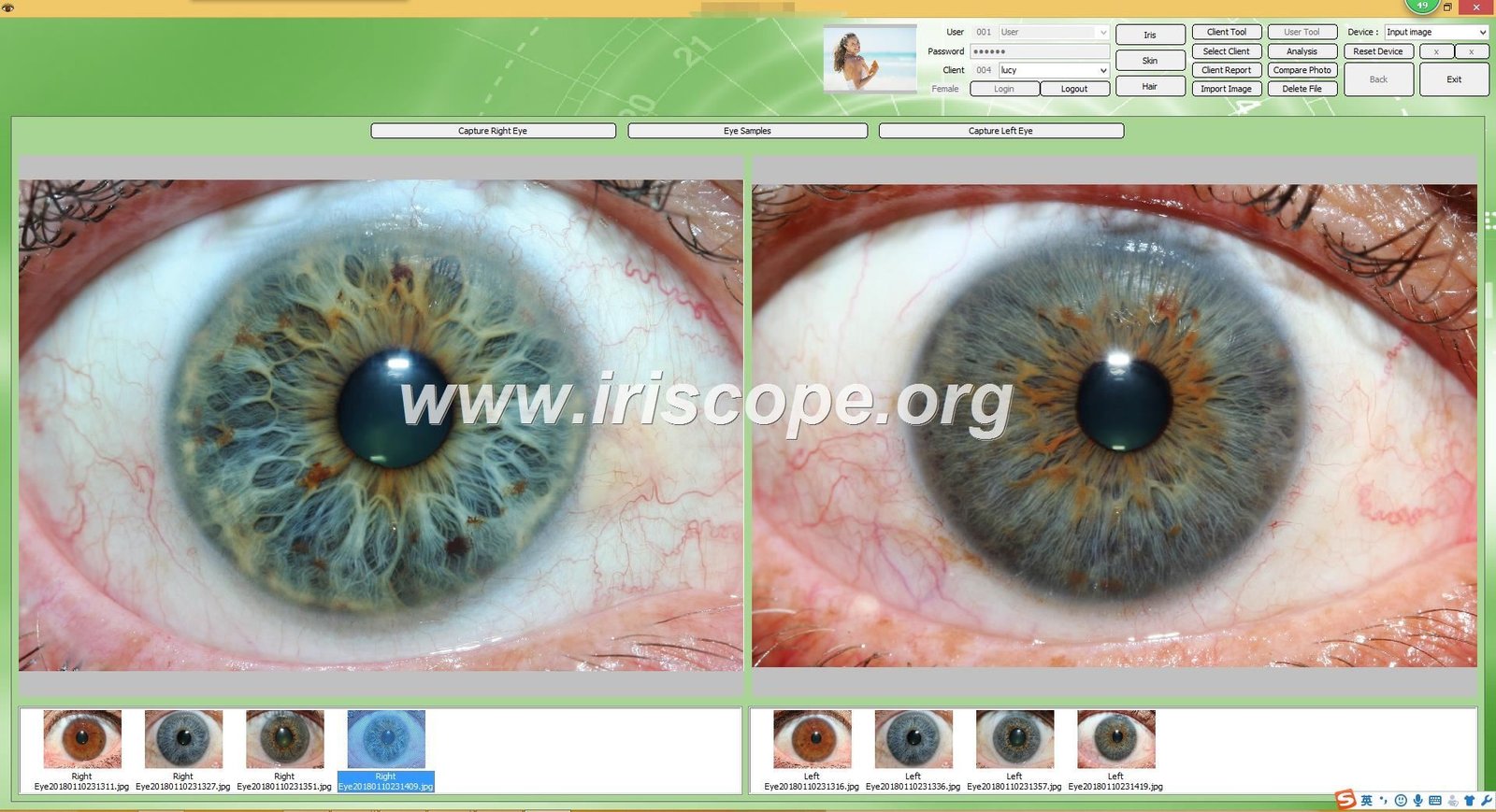 Iridology software for mac 31 1