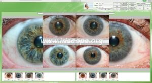 12MP Iriscopio