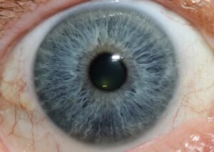 12MP Iriscopio