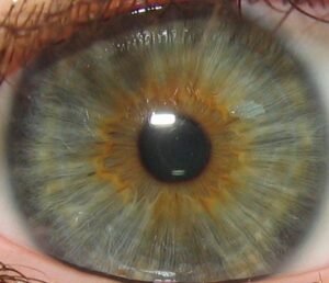 12MP Iriscopio
