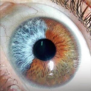 20 Iridólogos Autorizados en Australia