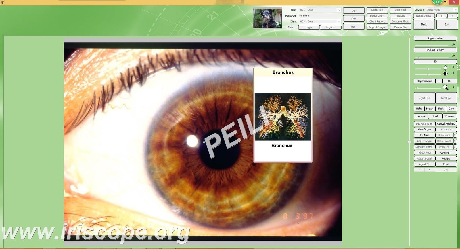 MAIKONG IRIDOLOGY CAMERA 27
