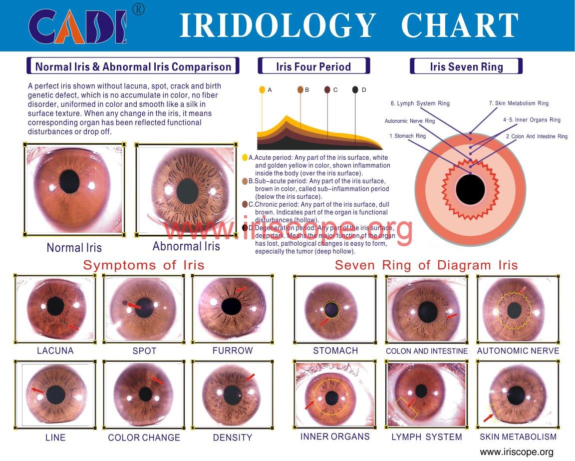 MAIKONG IRIDOLOIGY CHART 5
