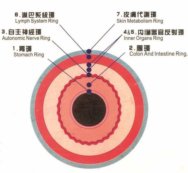 Seven Res Iridology and Health Implications