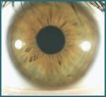 Estructura del Ojo y Funciones del Iris