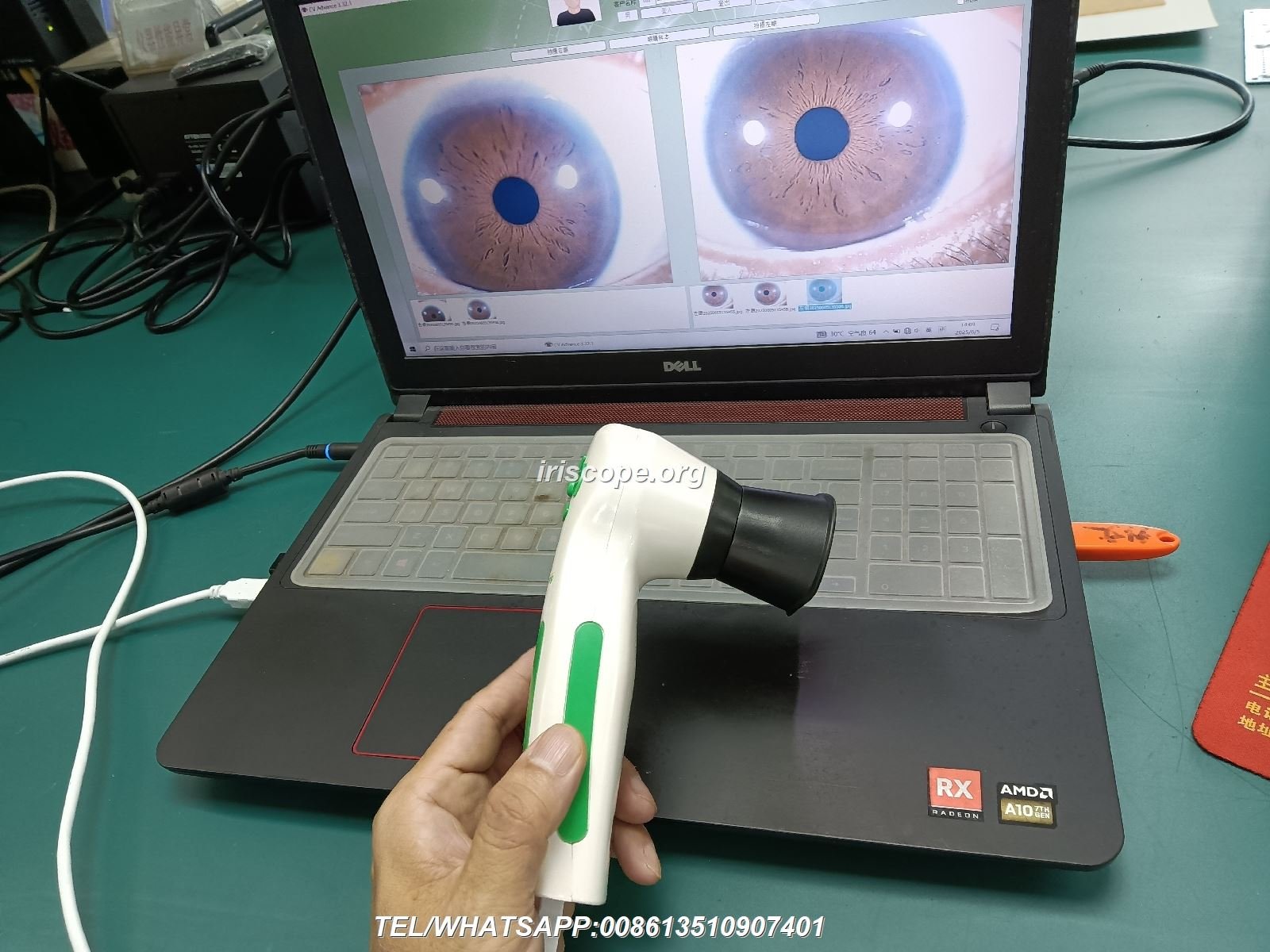 MAIKONG 5MP Iridology camera MK 980U MK 980U — 00020.JPG