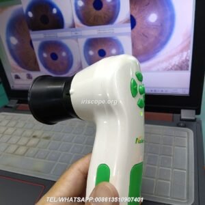 MAIKONG 5MP Iridology camera MK 980U MK 980U — 00028.JPG