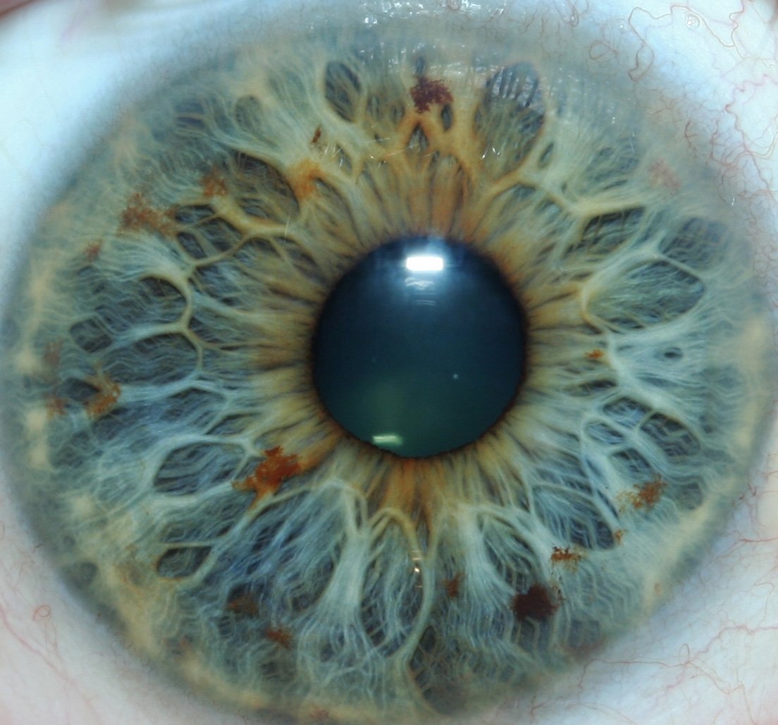 MAIKONG 5MP Iridology camera MK 980U — 008-1.jpg