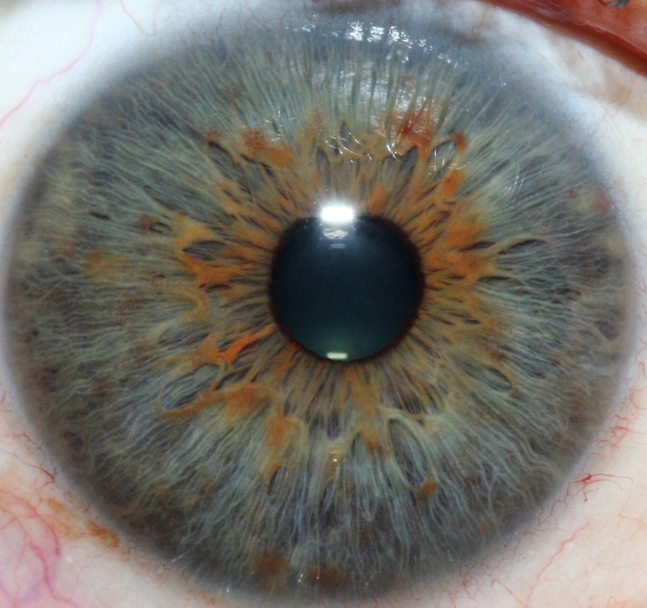 MAIKONG 5MP Iridology camera MK 980U — 010-1.jpg