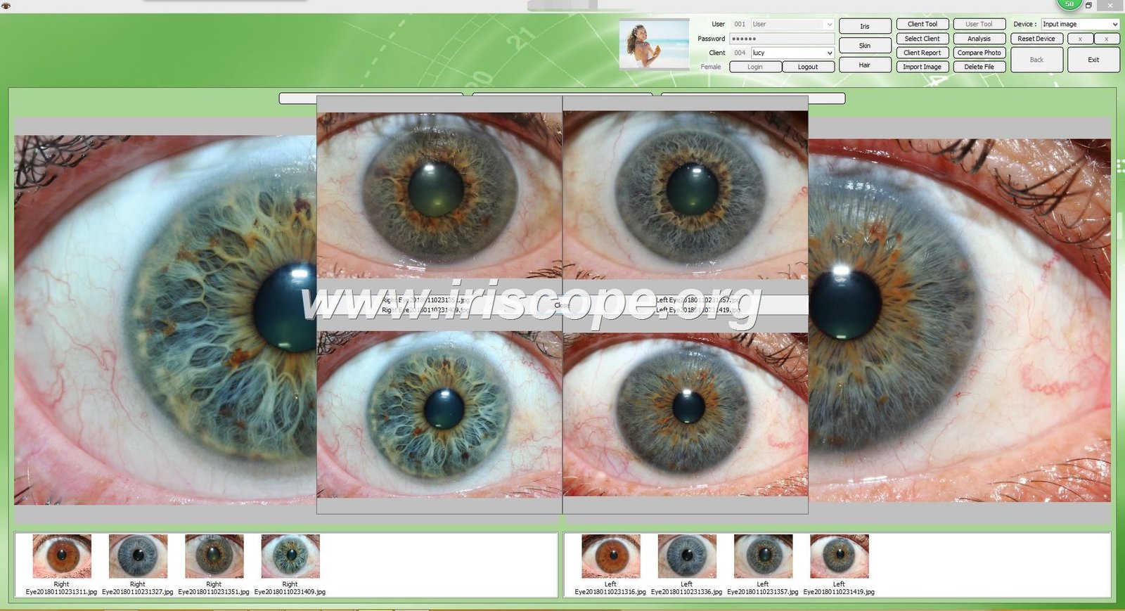 MAIKONG WIFI 20MP Iriscope camera — 033.JPG