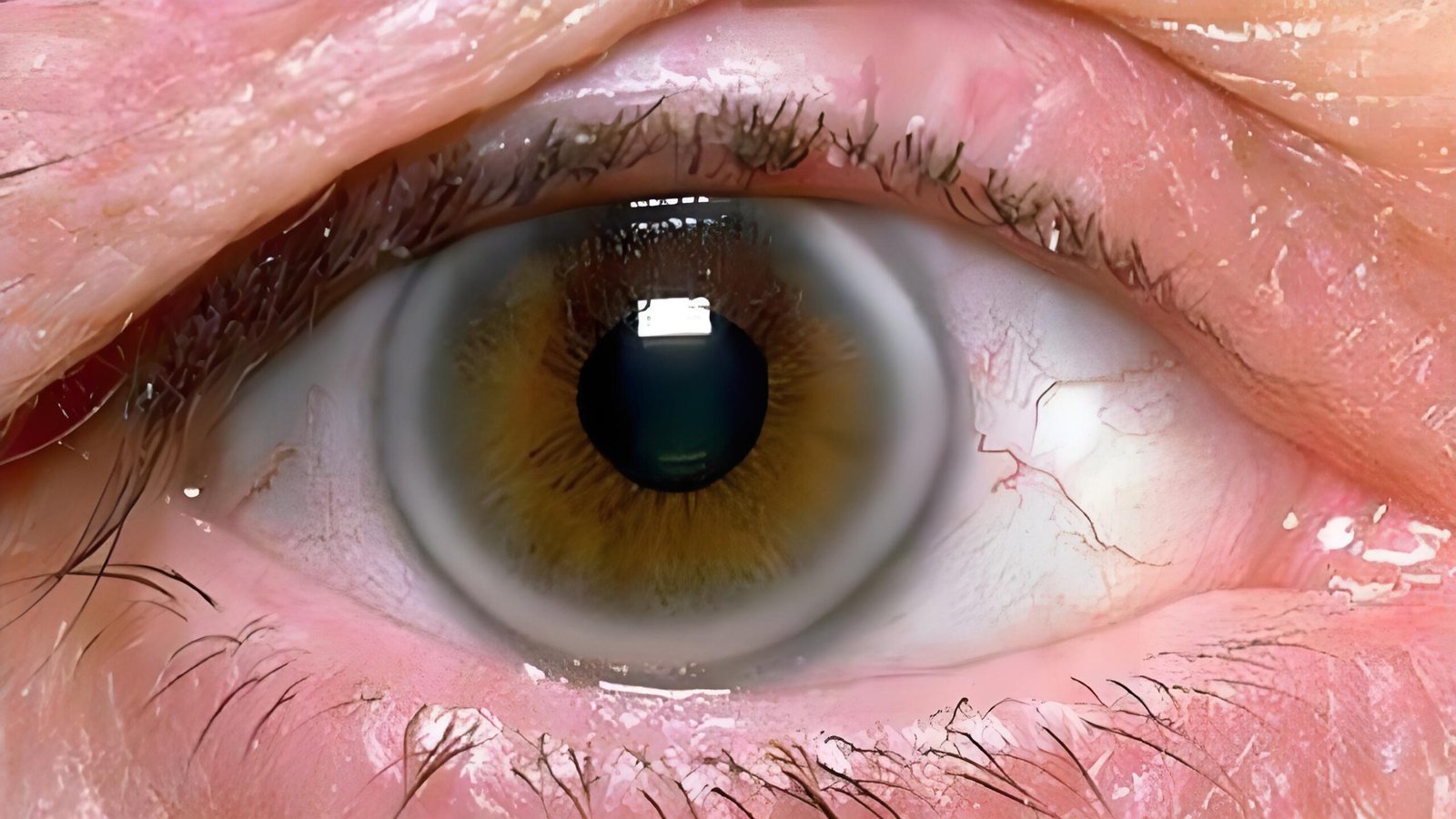 Cómo elegir un proveedor fiable de iriologo para venta al por mayor en México — Iridology Iris sodium ring (3).jpg