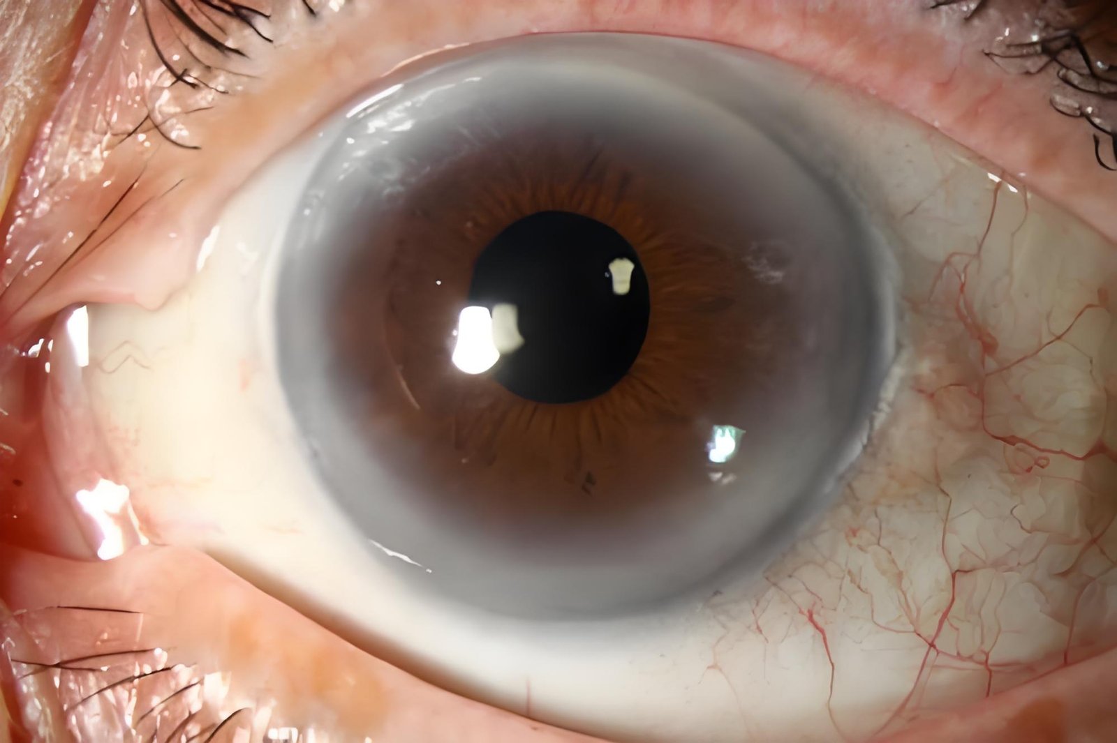 Cómo elegir un proveedor fiable de iriologo para venta al por mayor en México — Iridology Iris sodium ring (4).jpg