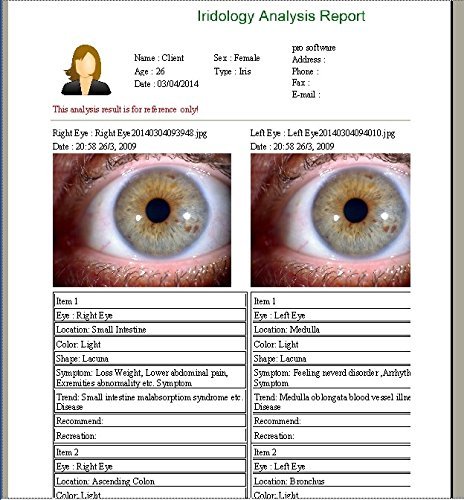 MAIKONG 5MP Iridology camera MK 980U MK 980U — MAIKONG IRIDOLOGY CAMERA (866).jpg