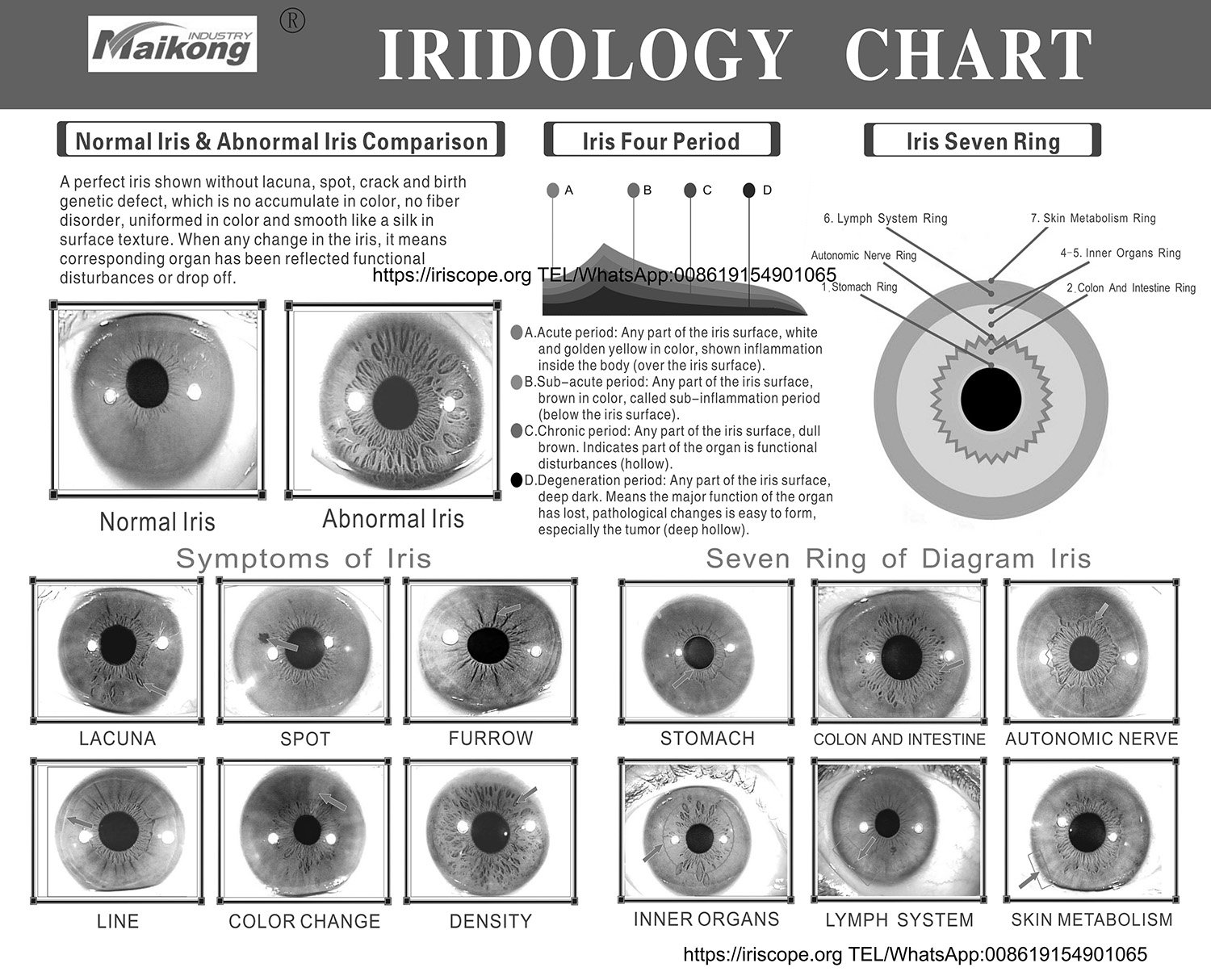 Iridología y el mapa del ojo: qué es, a quién va dirigido y qué verificar antes de venderlo online en México — MAIKONG iridologia mapa (10).jpg