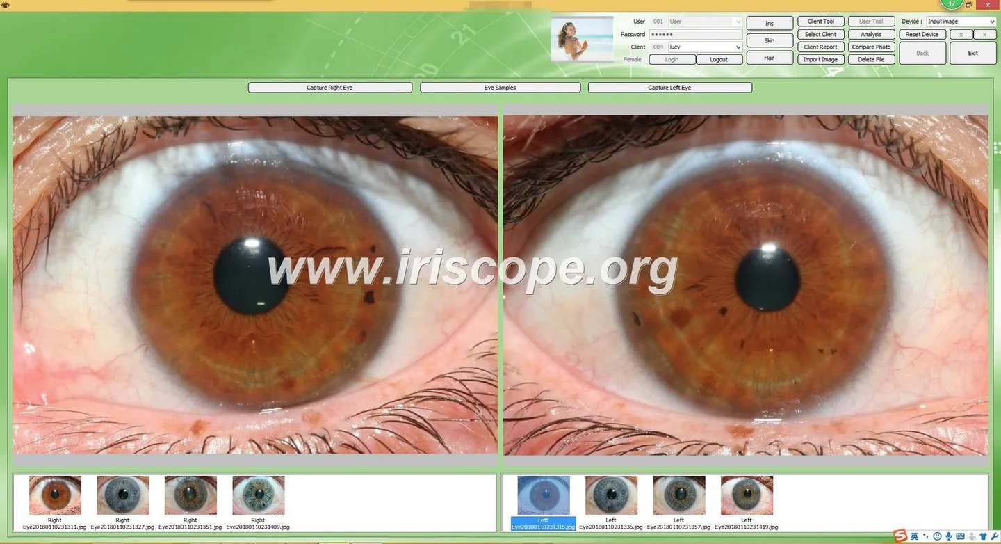 Dónde comprar equipos profesionales de iridología en México: opciones prácticas para agentes y distribuidores — iridology software 29.JPG