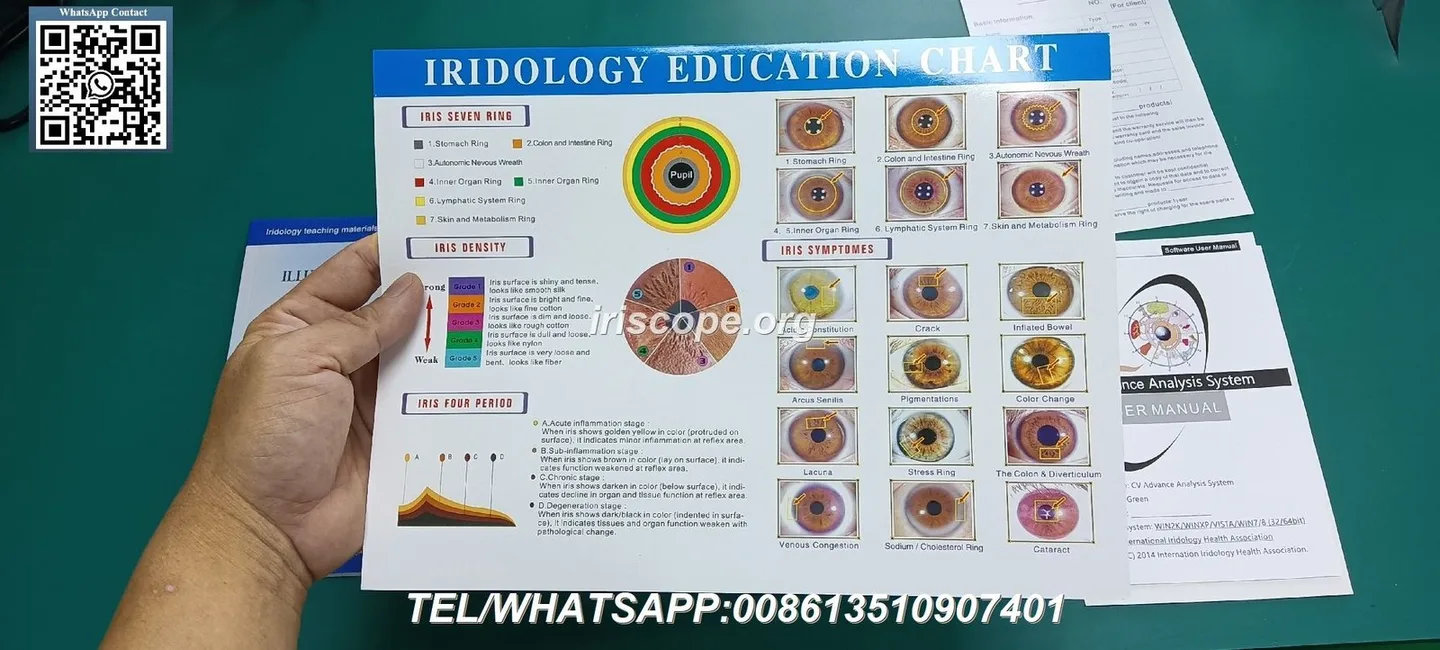Fabricantes de iridología para distribuidores en México: guía práctica desde MAIKONG 3 Fabricantes de iridología para distribuidores en México: guía práctica desde MAIKONG — iriscope iridologie (60).JPG