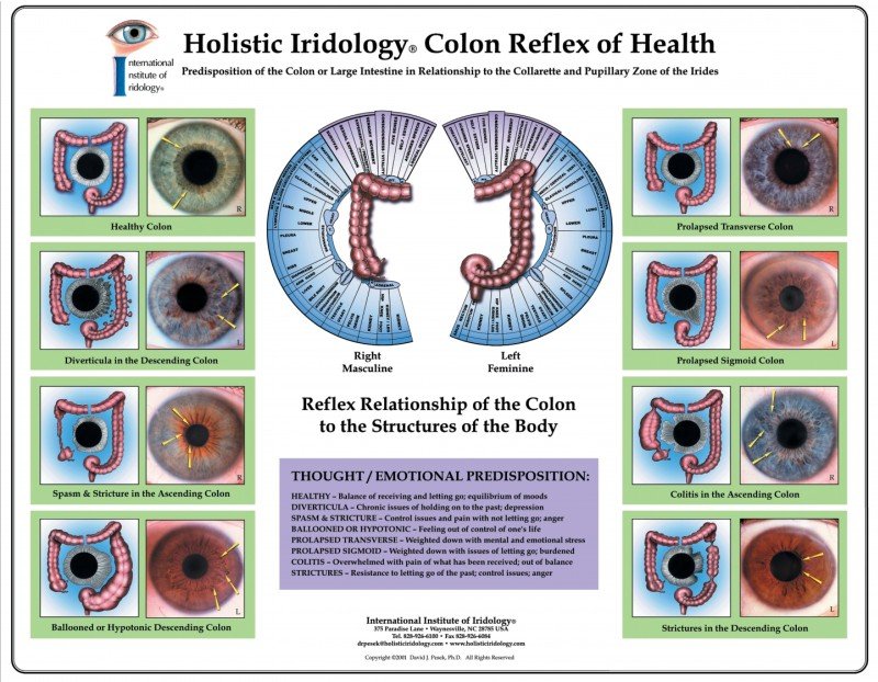 ¿Qué se debe comparar antes de comprar iridologia que es? — iridology charts.jpg