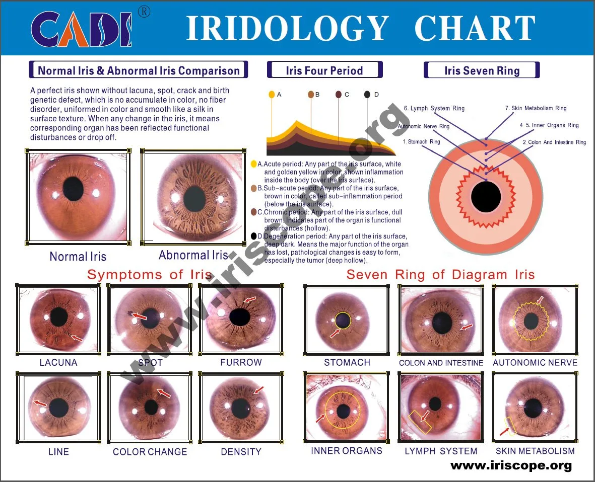 MAIKONG WIFI 20MP Iriscope camera MK 9888U — iridology chart from maikong free (11).jpg