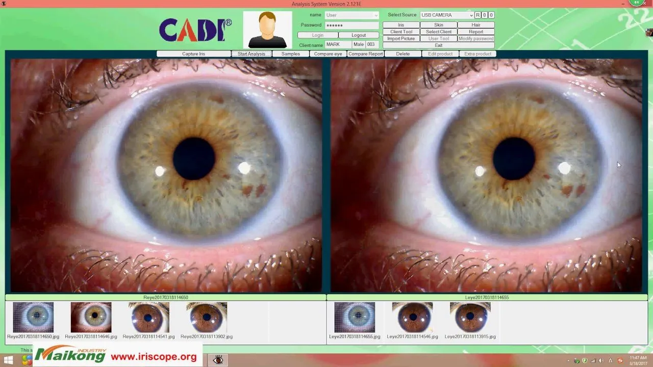 Qué comparar antes de comprar equipos de iridología: guía práctica para distribuidores y emprendedores en México — MAIKONG IRIDOLOGY CAMERA (655).jpg