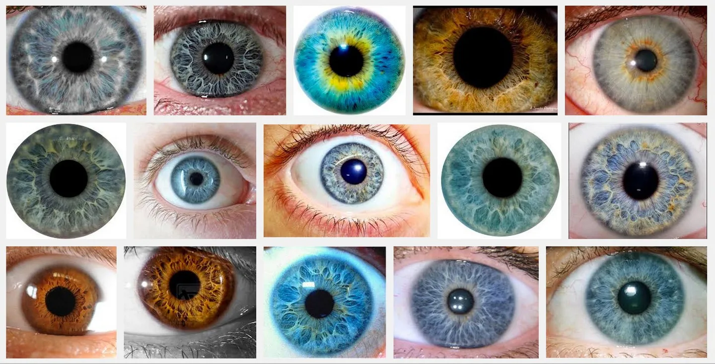 Soporte de fábrica para adaptaciones de monturas y hardware según necesidades de México — MAIKONG IRIDOLOGY CAMERA (887).JPG