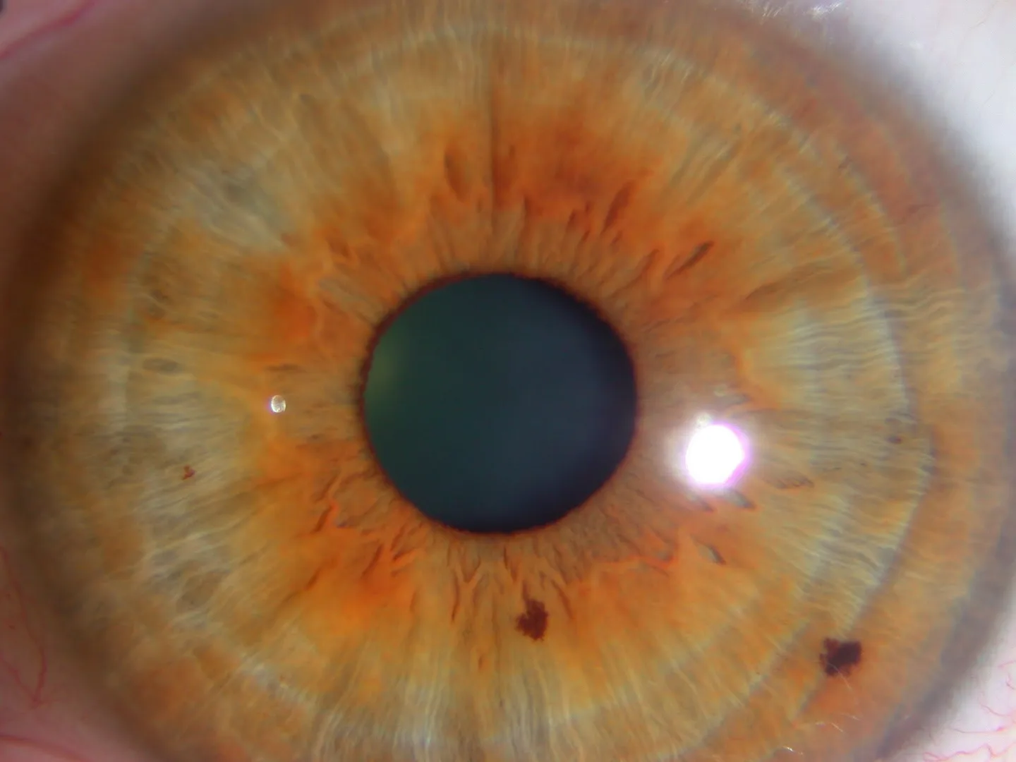 iridology — Iridología (8).jpg