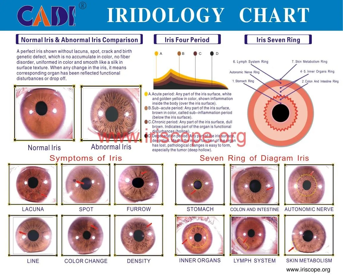 Mapa iridológico: qué es, para quién sirve y qué verificar antes de revender software en México — maikong Iridology Chartsjpg (9).JPG
