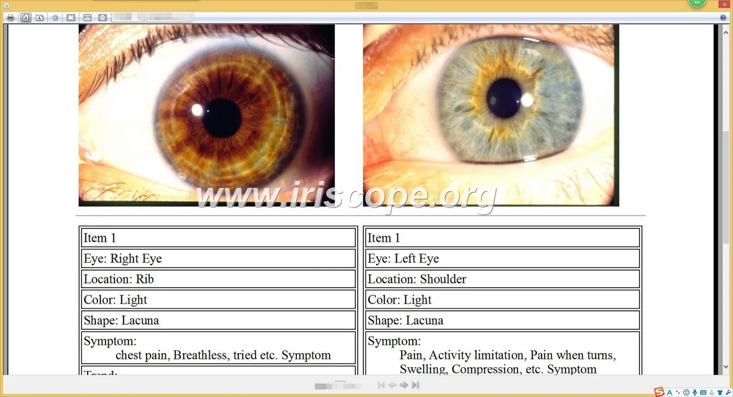 Mapa iridológico: qué es, para quién sirve y qué verificar antes de revender software en México — iridology software 25.JPG