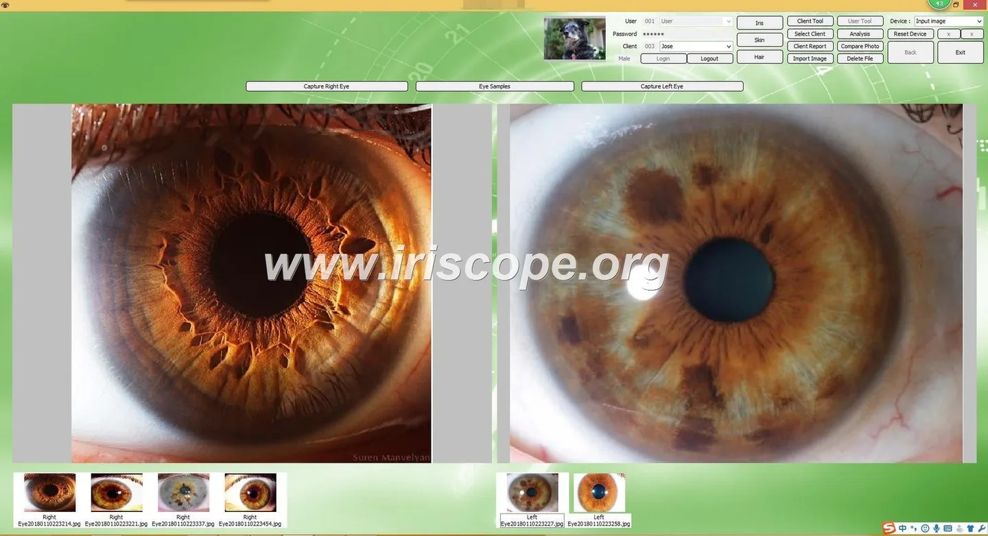 Mapa iridológico: qué es, para quién sirve y qué verificar antes de revender software en México — iridology software.JPG